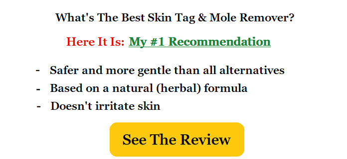 best skin tag mole