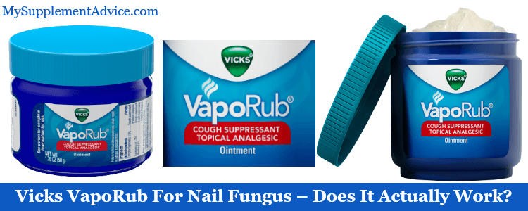 Vicks VapoRub For Nail Fungus – Does It Actually Work?