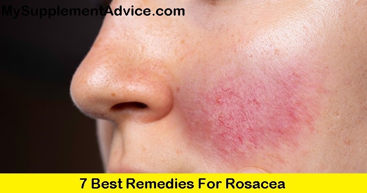 7 Best Remedies For Rosacea (2022)
