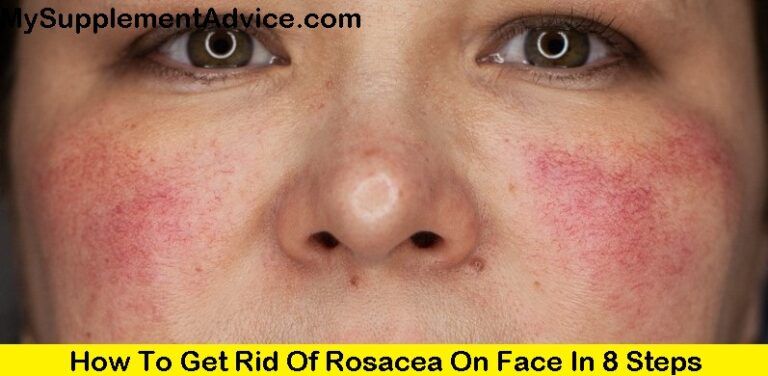 how do i get rid of rosacea rash on my face