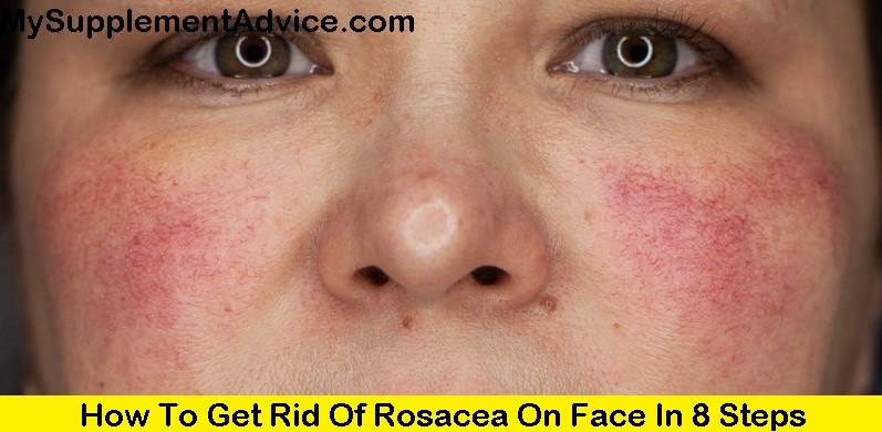 How To Get Rid Of Rosacea On Face In 8 Steps (2024)