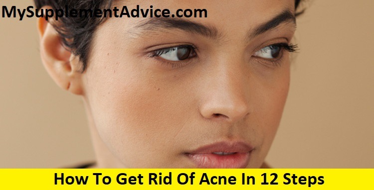 How To Get Rid Of Acne In 12 Steps (2024)