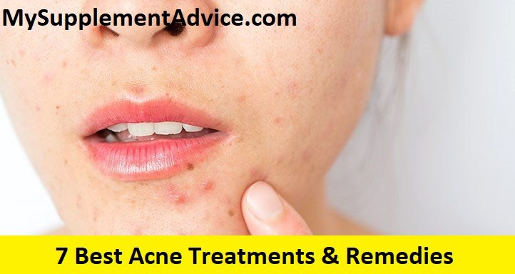 7 Best Acne Treatments & Remedies (2022)