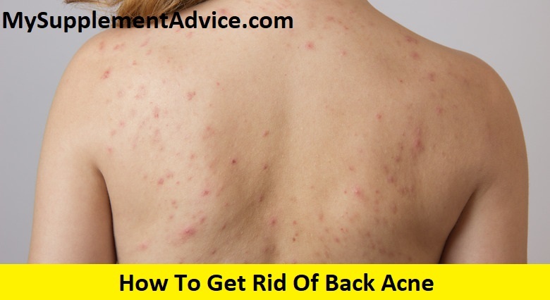 How To Get Rid Of Back Acne In 8 Steps (2022)