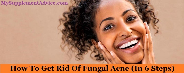 How To Get Rid Of Fungal Acne (In 6 Steps)