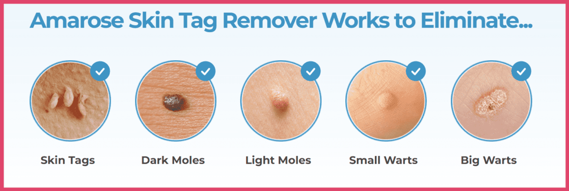 Amarose Skin Tag Remover Price