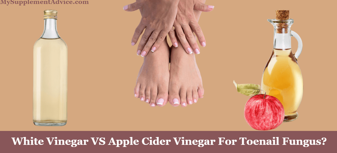 White Vinegar VS Apple Cider Vinegar For Toenail Fungus – Which Is The #1? (2023)